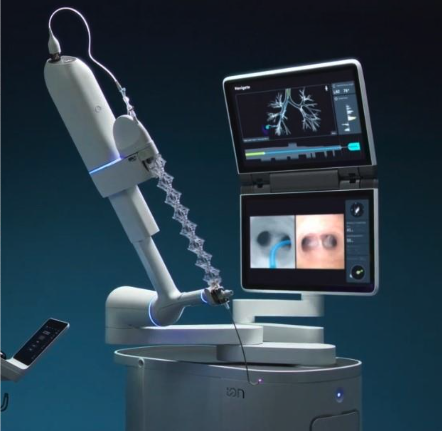 Ion Robotic-Assisted Bronchoscopy System